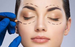 Göz kapağı düşmesi ameliyatı Ankara