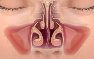 Burun kemiği eğriliği