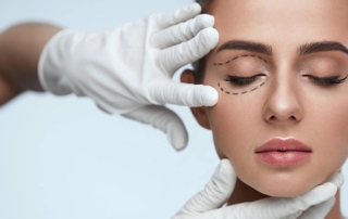 Ankara göz kapağı doktor önerisi