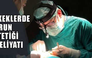 Erkekl Burun Estetiği Ankara