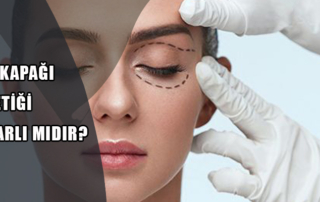 Göz Kapağı Estetiği Zararlı Mıdır?