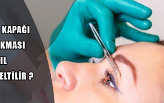 Göz kapağı sarkması