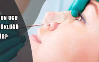 Burun Ucu Düşüklüğü Nedir?