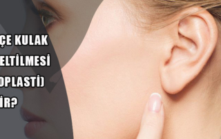 Kepçe Kulak Düzeltilmesi (Otoplasti) Nedir?