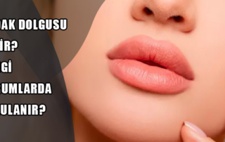 Dudak Dolgusu Nedir?