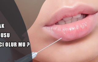 Dudak Dolgusu Kalıcı Olur Mu?
