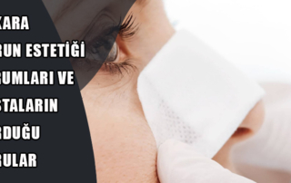 Burun Estetiği Yorumları