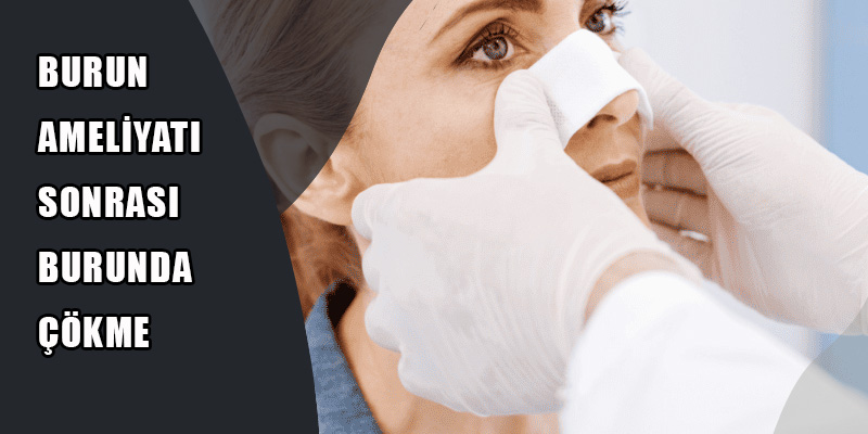Burun Ameliyatı Sonrası Burunda Çökme