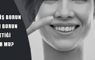 Geniş Burun Estetiği
