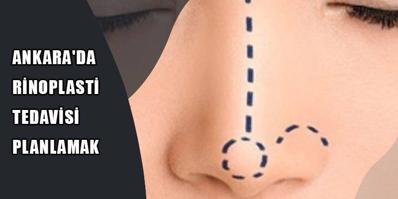 Ankara'da Rinoplasti Tedavisi Planlamak