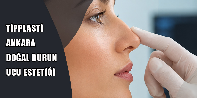 Tipplasti Ankara
